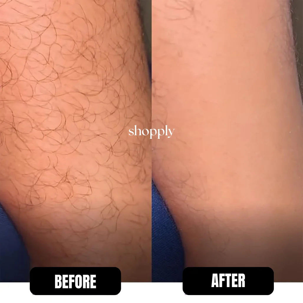 shopply™️ Crystal Hair Remover